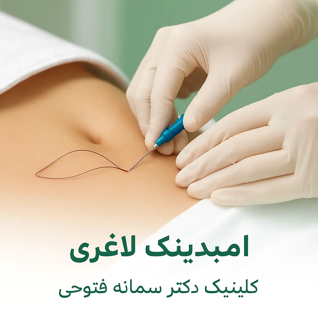 امبدینگ لاغری