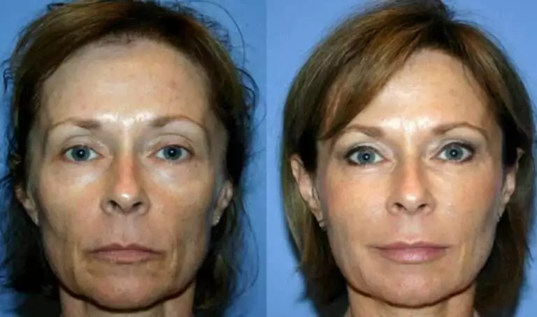 همین حالا نوبت خود را دریافت کنید