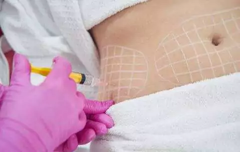 slimming mesotherapy.jpg