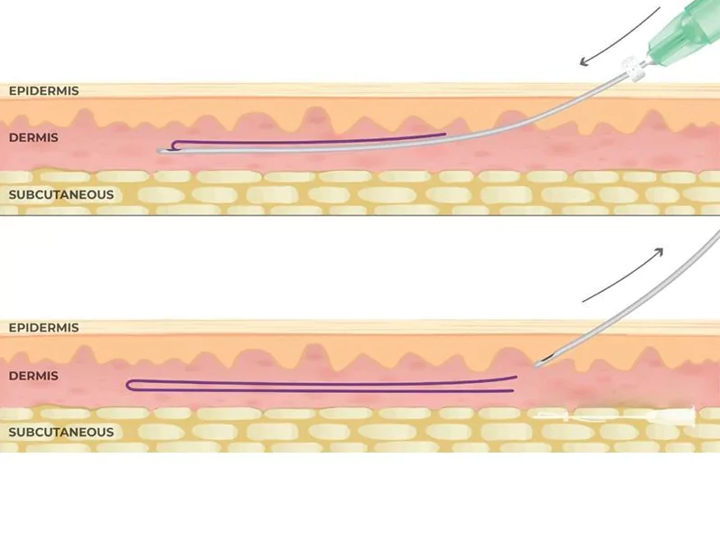 همین حالا نوبت خود را دریافت کنید
