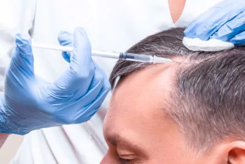 مزوتراپی سر 1 مزوتراپی