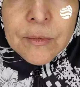 نمونه کار 4 drfotouhiclinic sample 2
