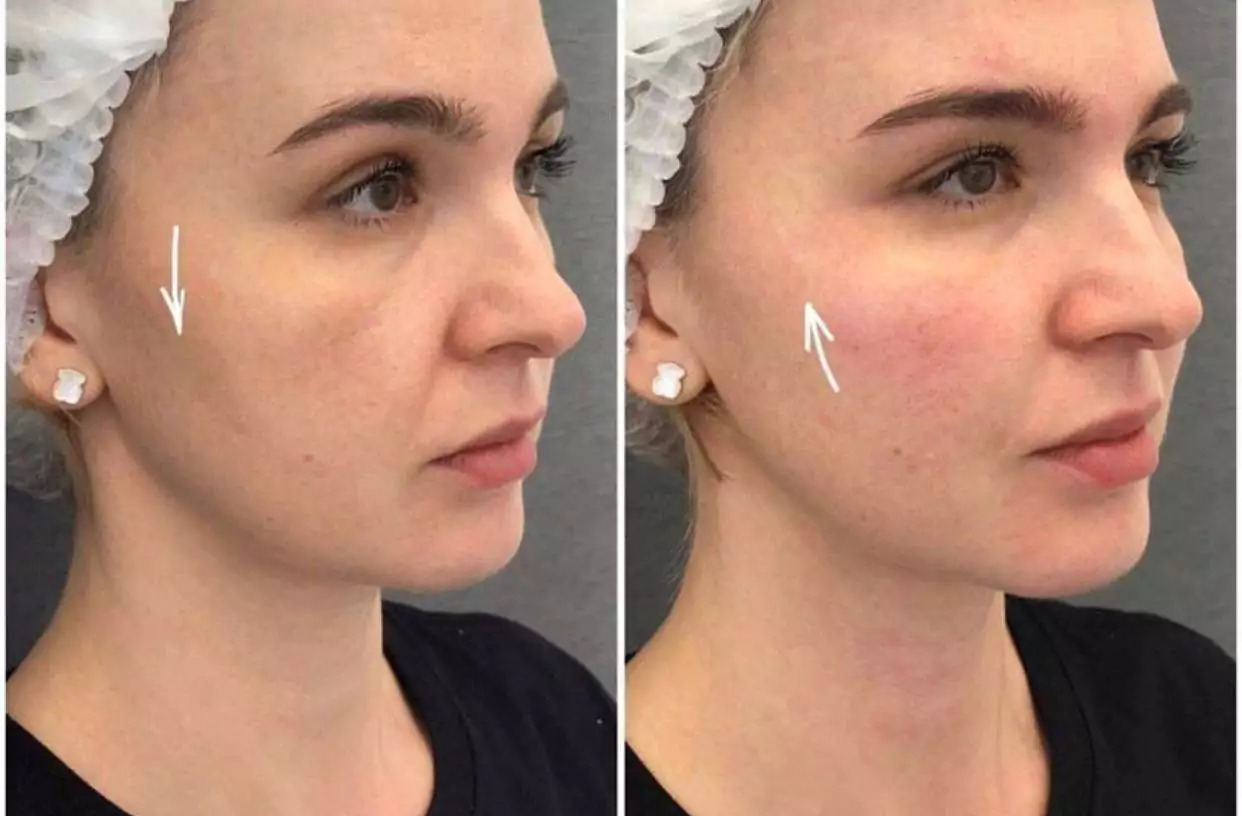 چه زمانی افراد نیاز به کانتورینگ صورت پیدا می‌کنند؟