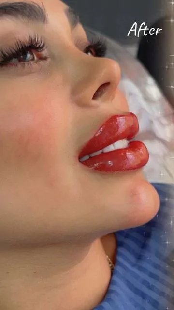 زاویه سازی صورت (کانتورینگ صورت) در شهرک غرب تهران (سعادت آباد) 4 نظر زیباجو درباره زاویه صورت و فک در کلینیک زیبایی در تهران