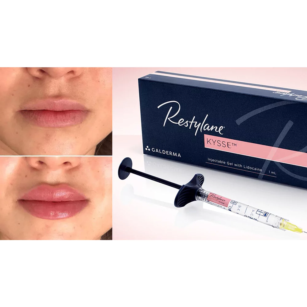 بهترین مارک ژل فیلر برای تزریق صورت: راهنمای انتخابی ایمن و موثر 4 ژل فیلر رستیلن (restylane)