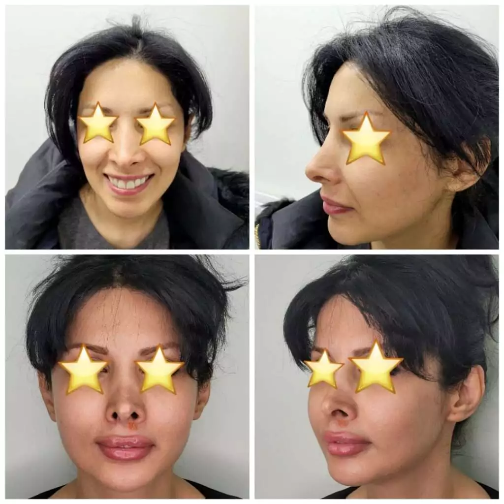 زاویه سازی صورت (کانتورینگ صورت) در شهرک غرب تهران (سعادت آباد) 6 work samples 1 min