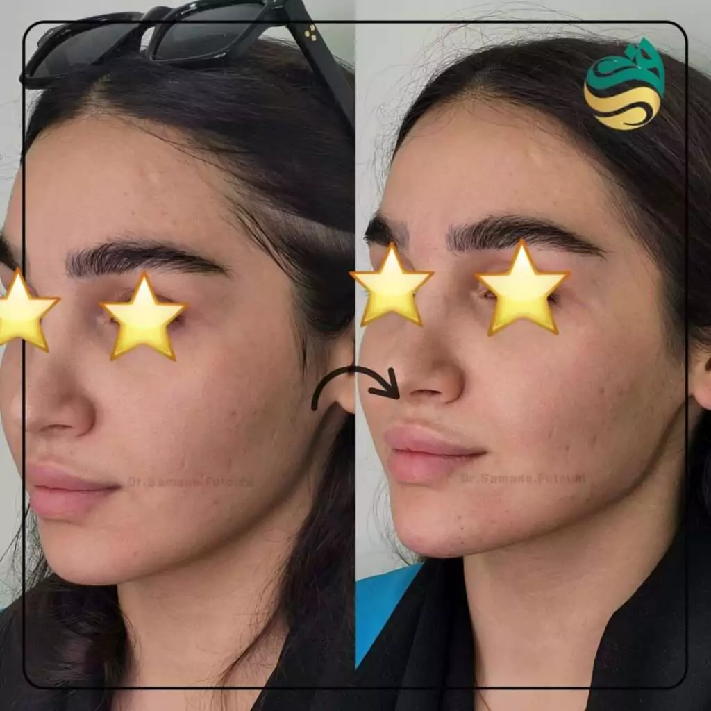 زاویه سازی صورت (کانتورینگ صورت) در شهرک غرب تهران (سعادت آباد) 8 work samples 2 min