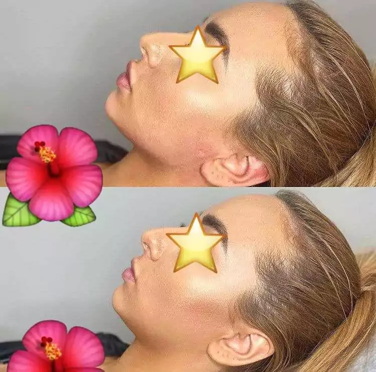 زاویه سازی صورت (کانتورینگ صورت) در شهرک غرب تهران (سعادت آباد) 7 work samples 3 min