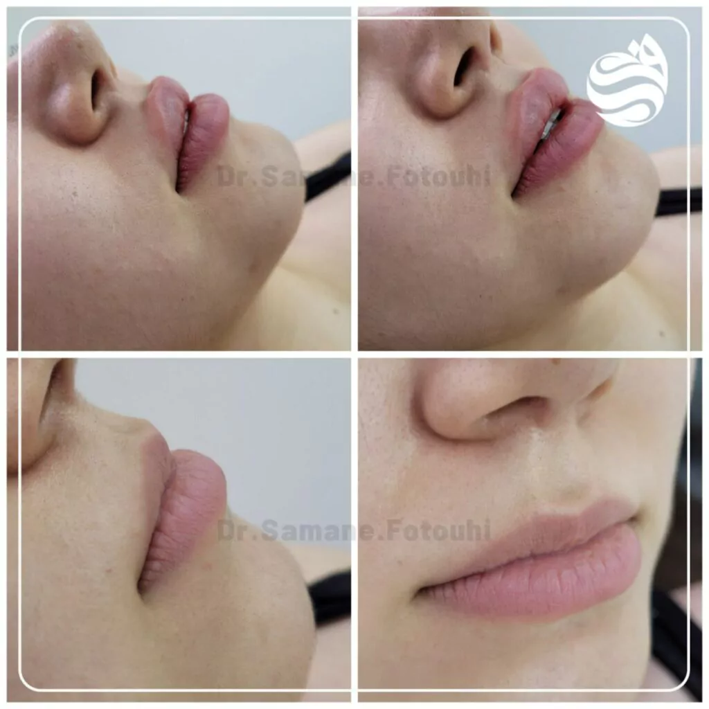 زاویه سازی صورت (کانتورینگ صورت) در شهرک غرب تهران (سعادت آباد) 10 work samples 5 min