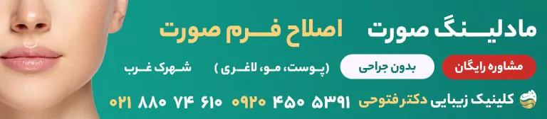 هزینه امبدینگ نخ لاغری چقدر است؟ 3 هزینه امبدینگ نخ لاغری در کلینیک دکتر فتوحی
