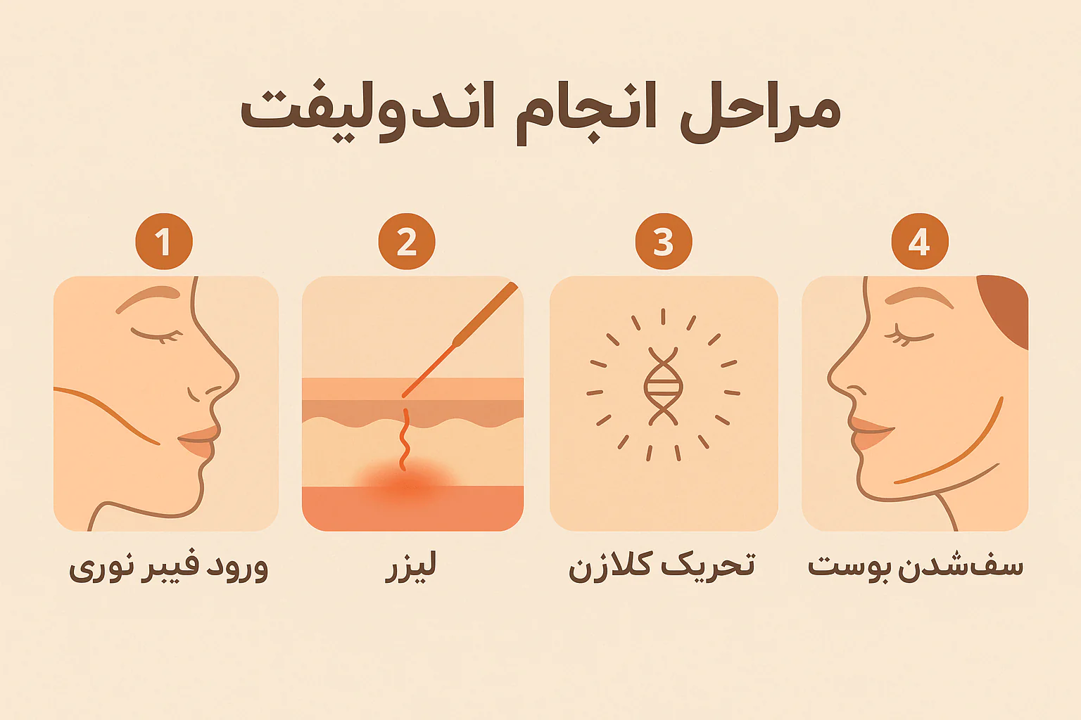 مراحل انجام اندولیفت